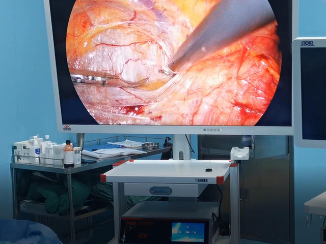 4k laparoscopy system