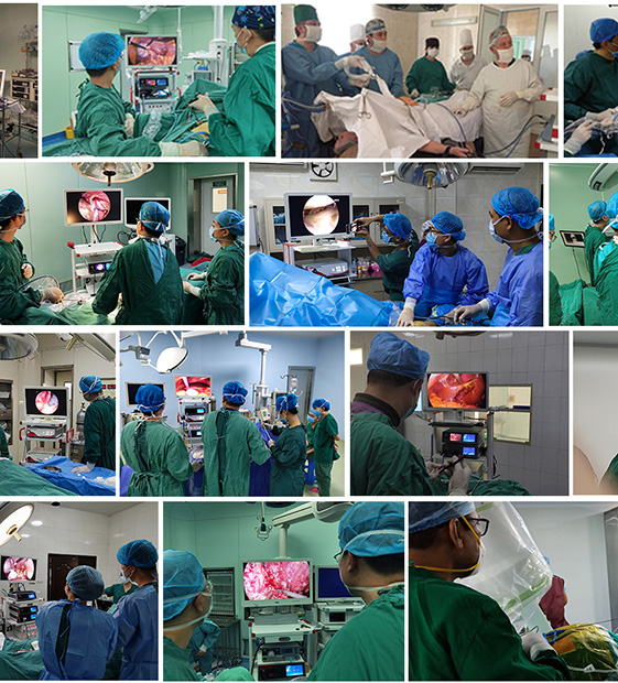 Endoscopic camera inspect surgery Equipment
